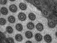 TEM image showing microvilli in the intestine of the nematode C. elegans.
