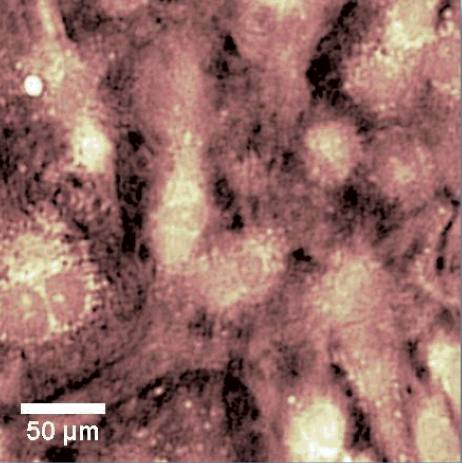 Holographic image of cardiamyocytes as an example for label-free imaging.